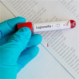 20230418  Legionella and Water Management.jpg skills on-demand image